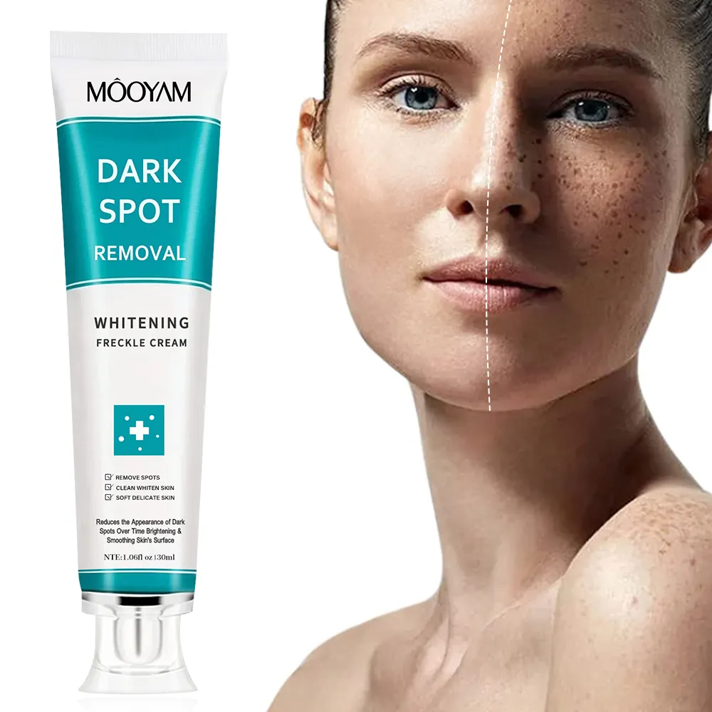 Private Label Strong Effective Whitening Freckle Cream Removal Melasma Dark Spot Melanin Remover Brighten Skin Face Cream