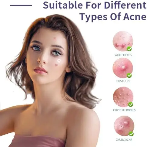 Waterproof Acne Pimple Patch Hydrocolloid Fast Healing Custom Logo Wholesale for All Skin Types