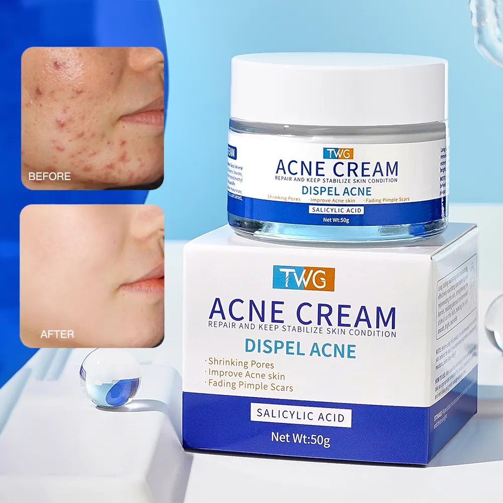 TWG RTS Salicylic Acid Anti Acne Cream Improve Acne Skin Nourishing Moisturizing Face Cream Fading Pimple Scars Anti Acne Cream
