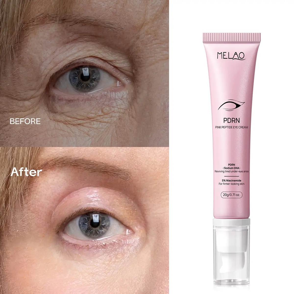 Private Label Eye Care Women's Eye Cream Under Bags Remove Firming Anti Wrinkle Multi-peptide Instant Cream Eye Tightener