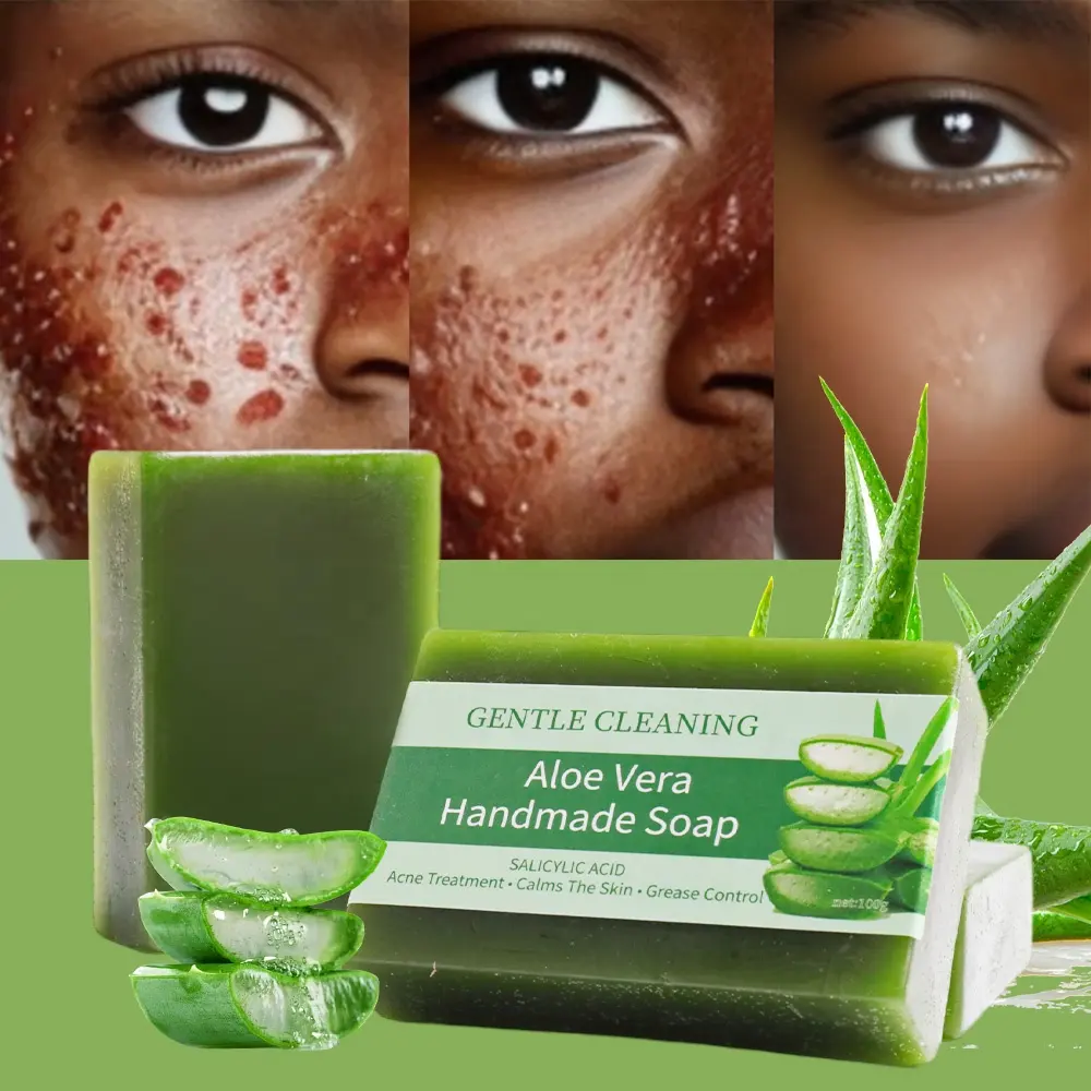 Wholesale Effective Acne Removal Facial Glowing Smoothing Deep Cleansing Bath Cool Fresh Aloe Vera Soaps