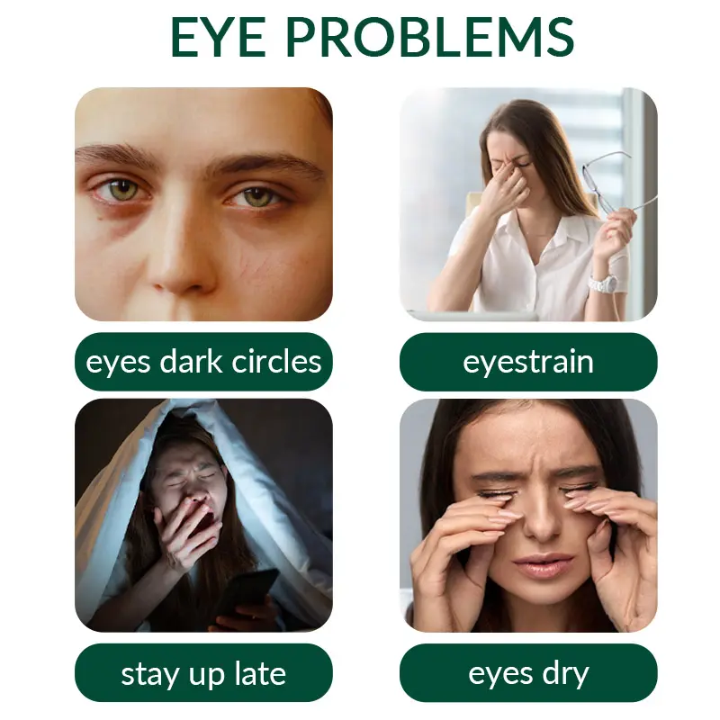 Anti-Wrinkle Natural Reduce Puffiness Brightening Eye Cream Non-Sticky Pre-Makeup Rescue Private Label Eye Serum