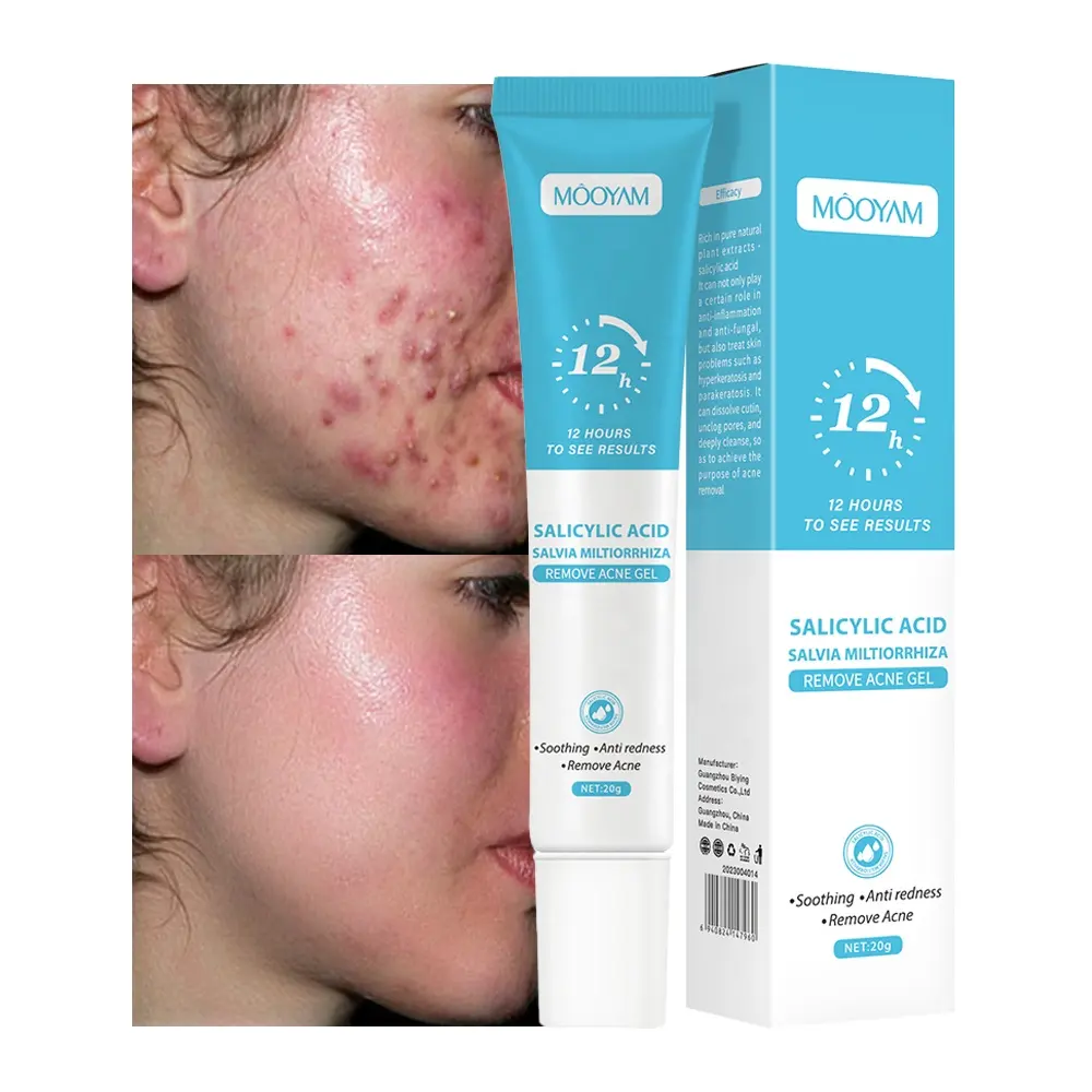 Fast Effective Repair Pimple Scar Anti Spots Removal Acne Gel Smooth Skin Shrink Pores Salicylic Acid Acne Face Cream